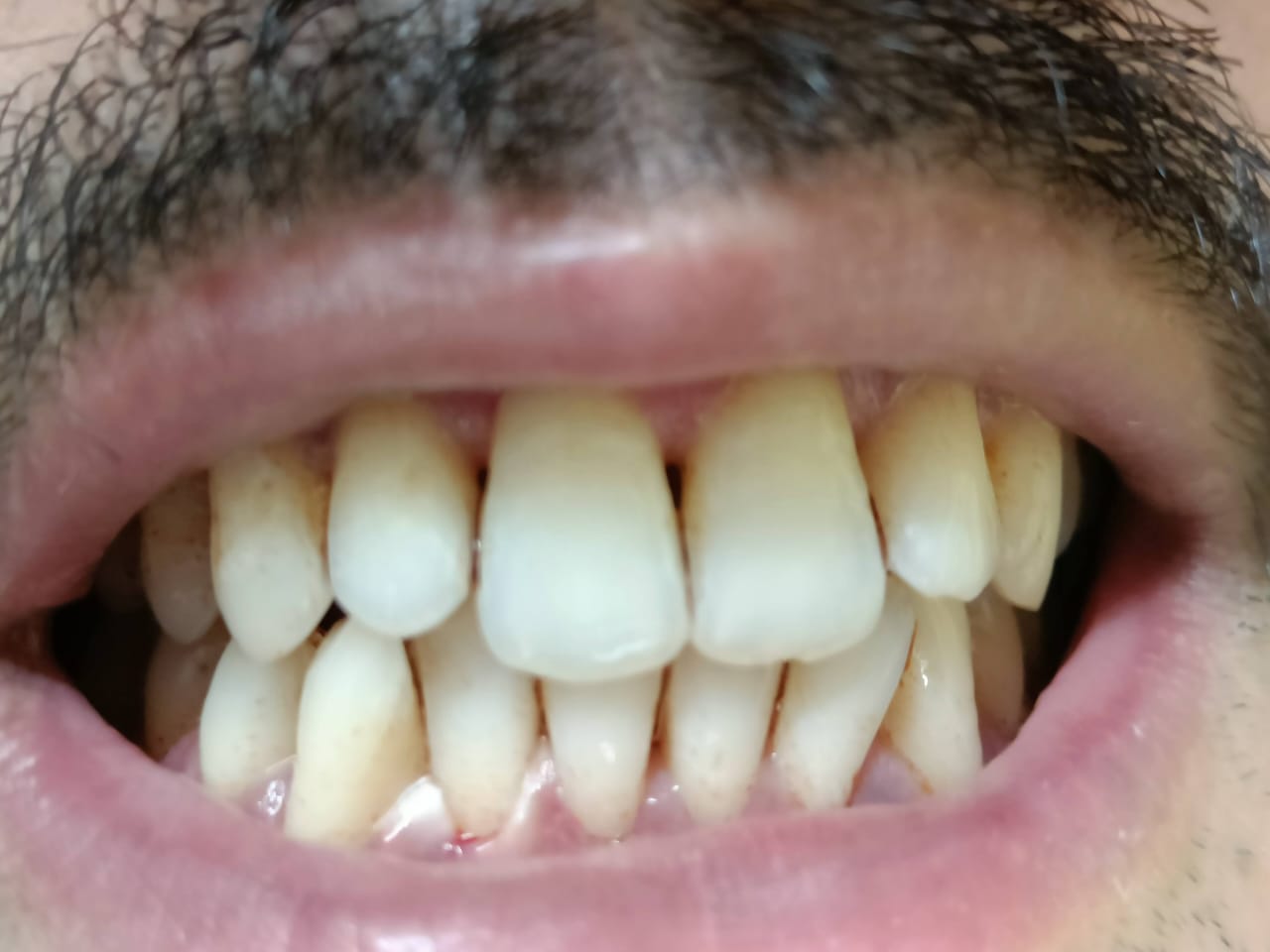 WhatsApp Image 2026-01-06 at 9.46.25 AM (1)