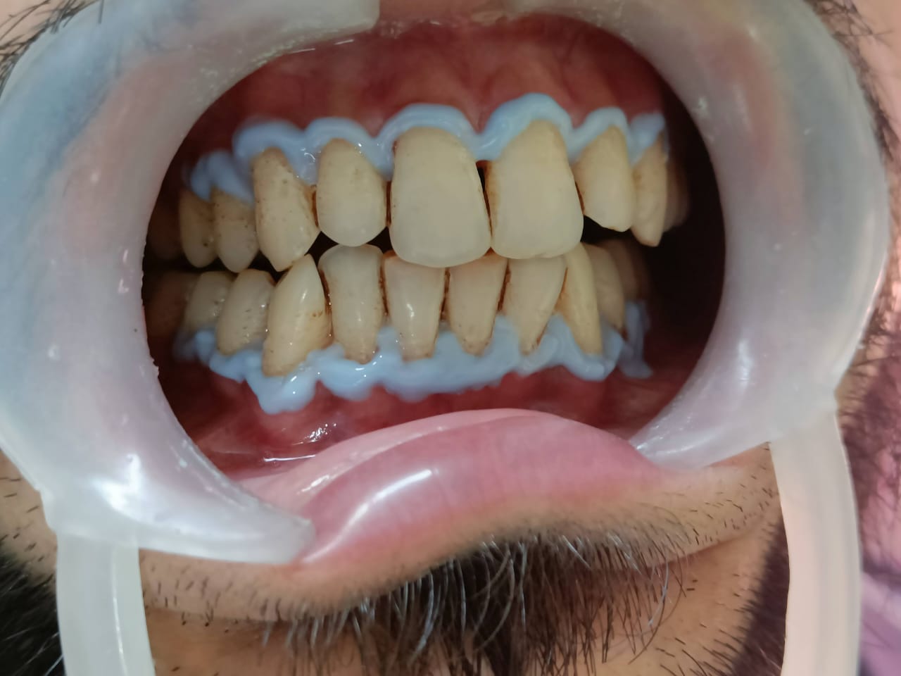 WhatsApp Image 2026-01-06 at 9.46.25 AM (2)